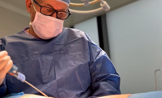 Tuk se na břiše ukládá i přes diety a cvičení – často jde o genetickou dispozici. Liposukce ho odstraní přesně tam, kde je potřeba, a vytvaruje postavu.