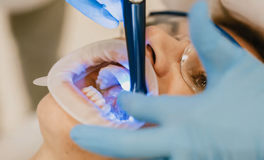 Nabízíme neviditelná i fixní rovnátka pod vedením specialistky na ortodoncii, v moderním zázemí ordinace Premier Smile na Jungmannově ulici.